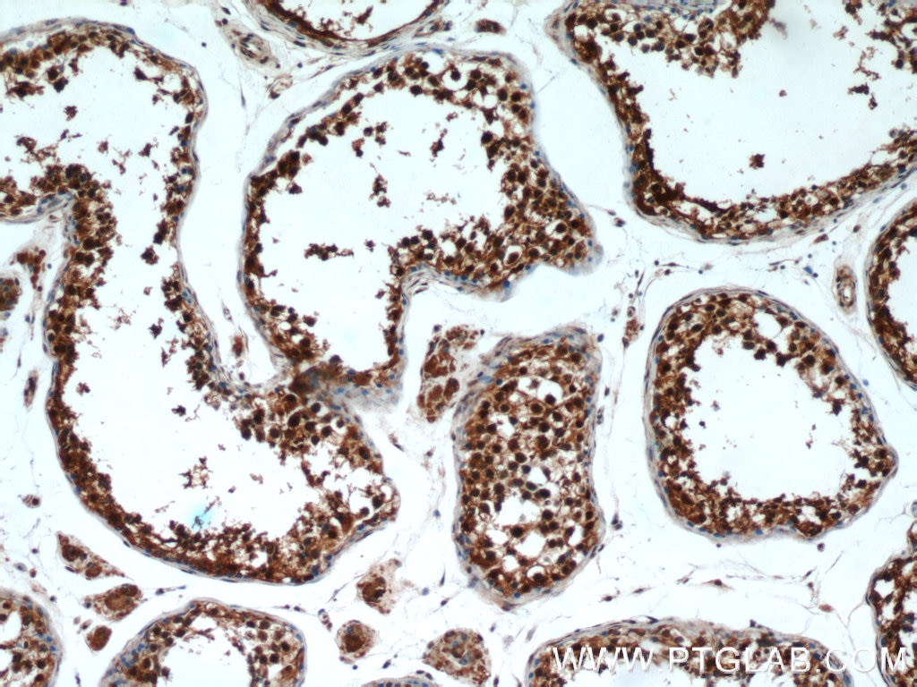 Immunohistochemistry (IHC) staining of human testis tissue using PSMA6 Polyclonal antibody (11573-1-AP)