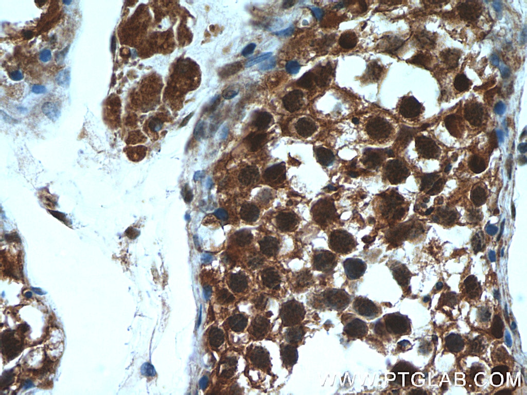 Immunohistochemistry (IHC) staining of human testis tissue using PSMA6 Polyclonal antibody (11573-1-AP)
