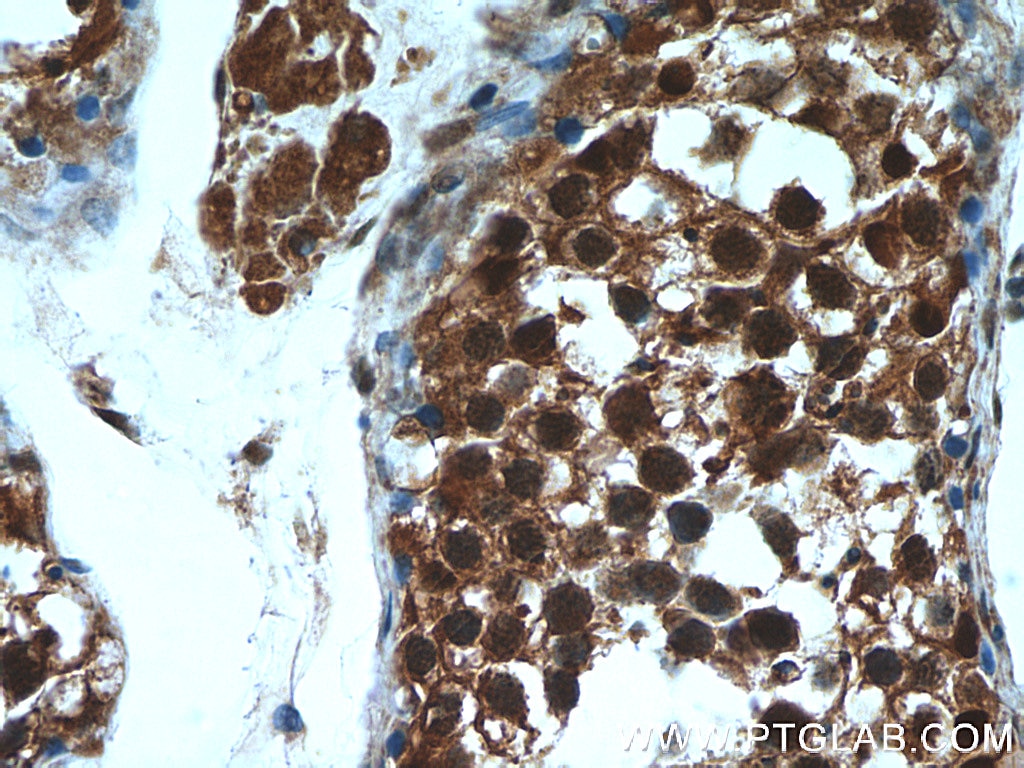 IHC staining of human testis using 11573-1-AP