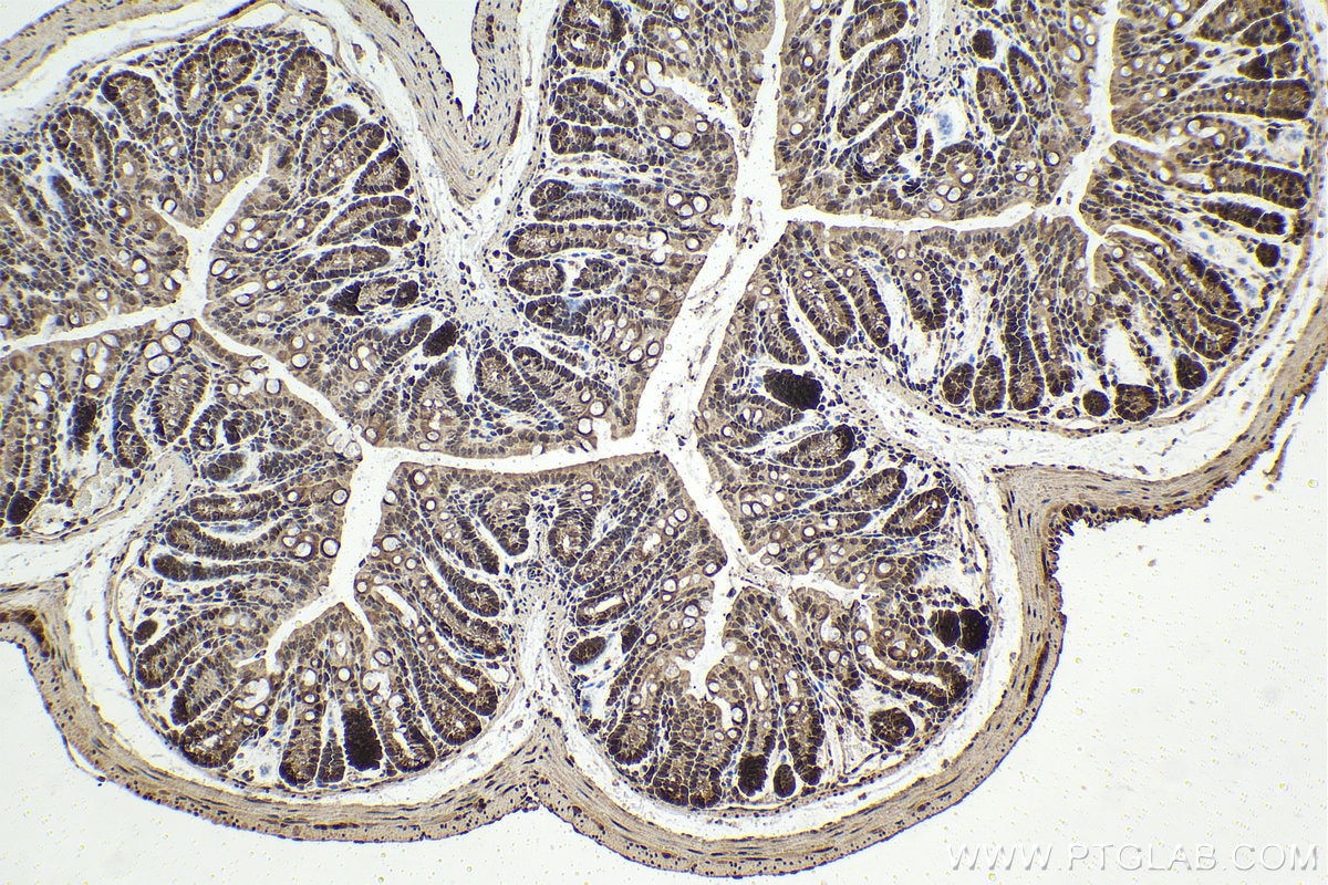 Immunohistochemistry (IHC) staining of mouse colon tissue using PSMA6 Polyclonal antibody (11573-1-AP)