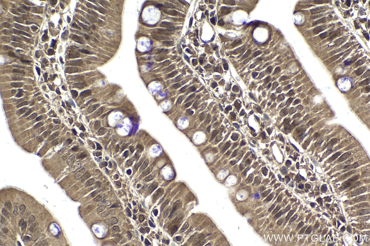Immunohistochemistry (IHC) staining of rat small intestine tissue using PSMA6 Polyclonal antibody (11573-1-AP)