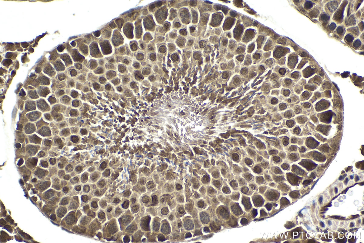 Immunohistochemistry (IHC) staining of rat testis tissue using PSMA6 Polyclonal antibody (11573-1-AP)