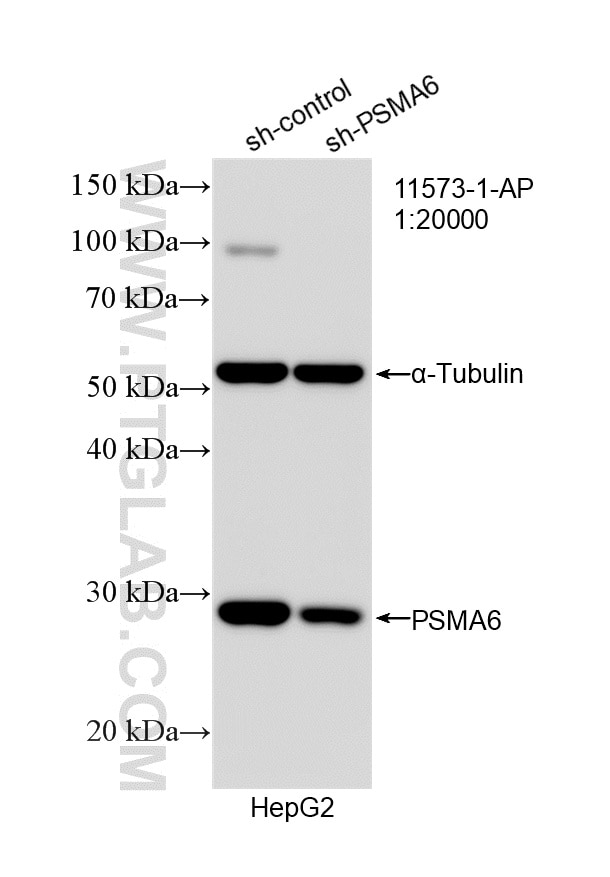 WB analysis of HepG2 using 11573-1-AP Western Blot (WB) analysis of HepG2 cells using PSMA6 Polyclonal antibody (11573-1-AP)
