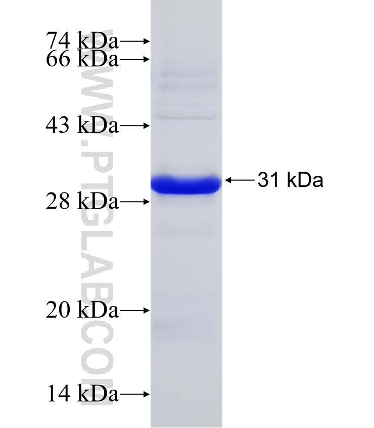 PSMA6 fusion protein Ag21761 SDS-PAGE
