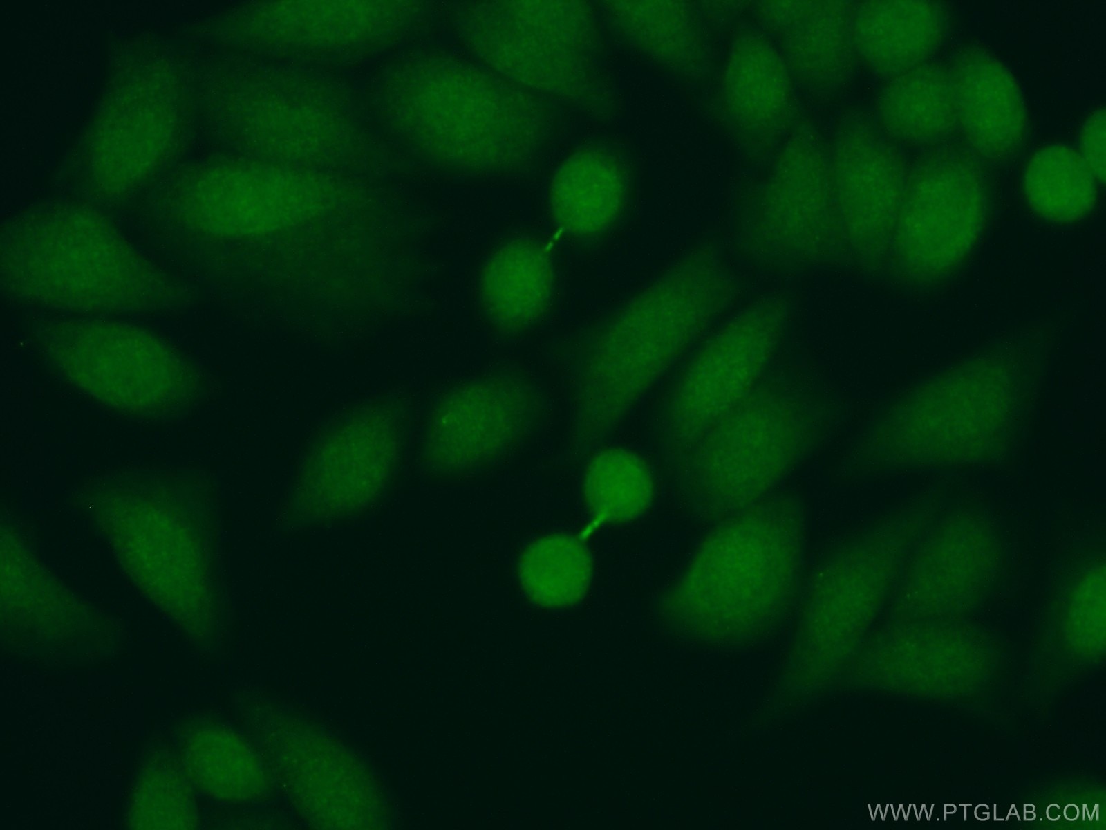 Immunofluorescence (IF) / fluorescent staining of HeLa cells using PSMA7 Polyclonal antibody (15219-1-AP)