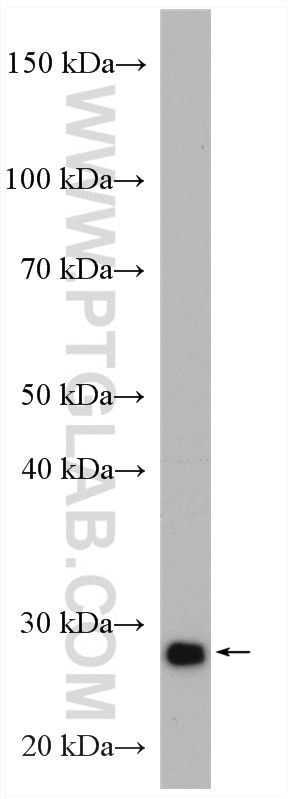 Western Blot (WB) analysis of HepG2 cells using PSMA7 Polyclonal antibody (15219-1-AP)