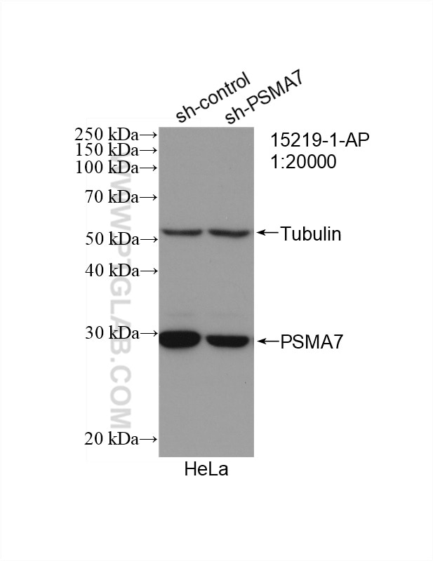 Western Blot (WB) analysis of HeLa cells using PSMA7 Polyclonal antibody (15219-1-AP)
