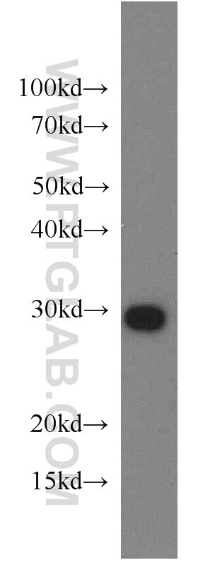 PSMA7 Polyclonal antibody