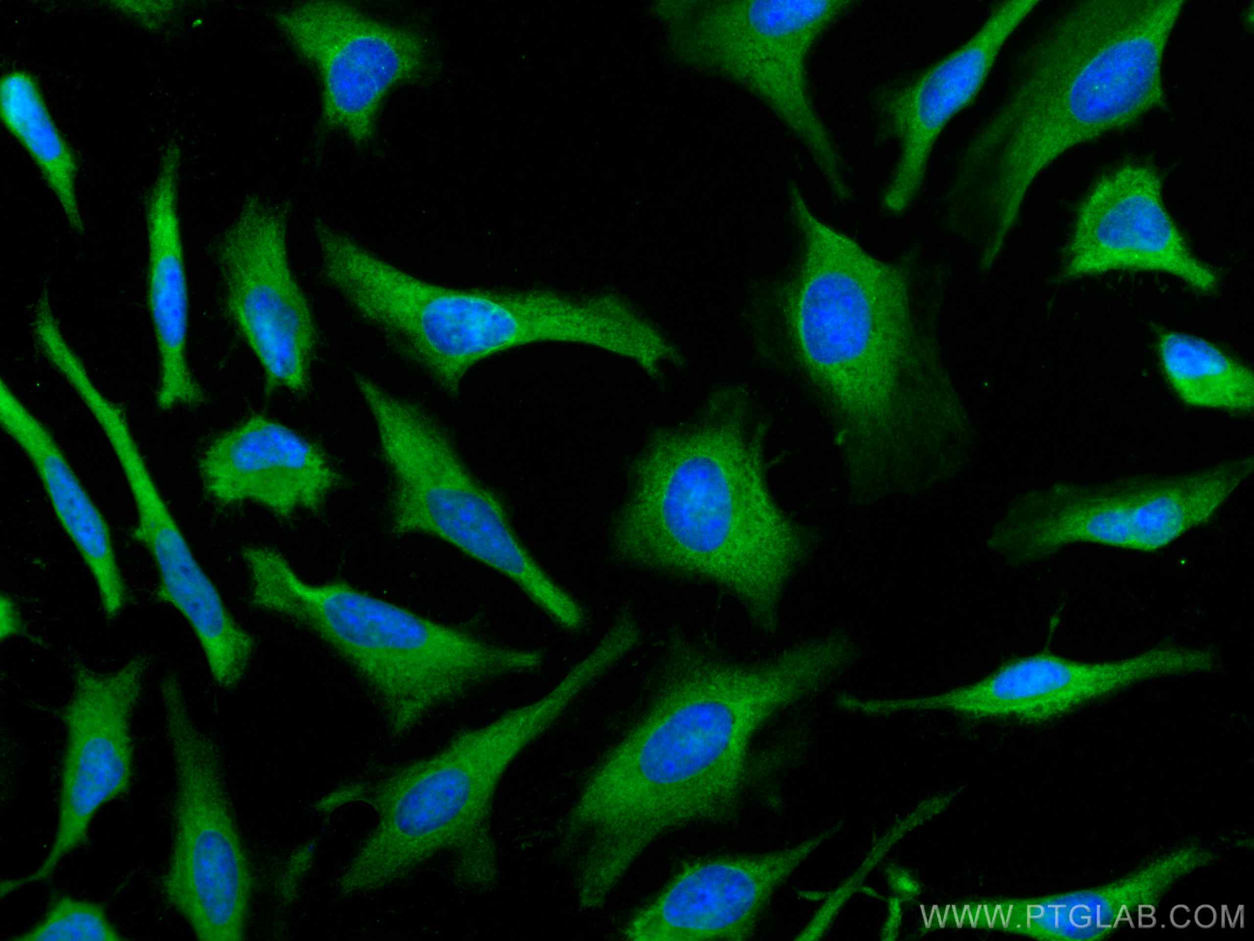 Immunofluorescence (IF) / fluorescent staining of HeLa cells using PSMA7 Monoclonal antibody (67817-1-Ig)