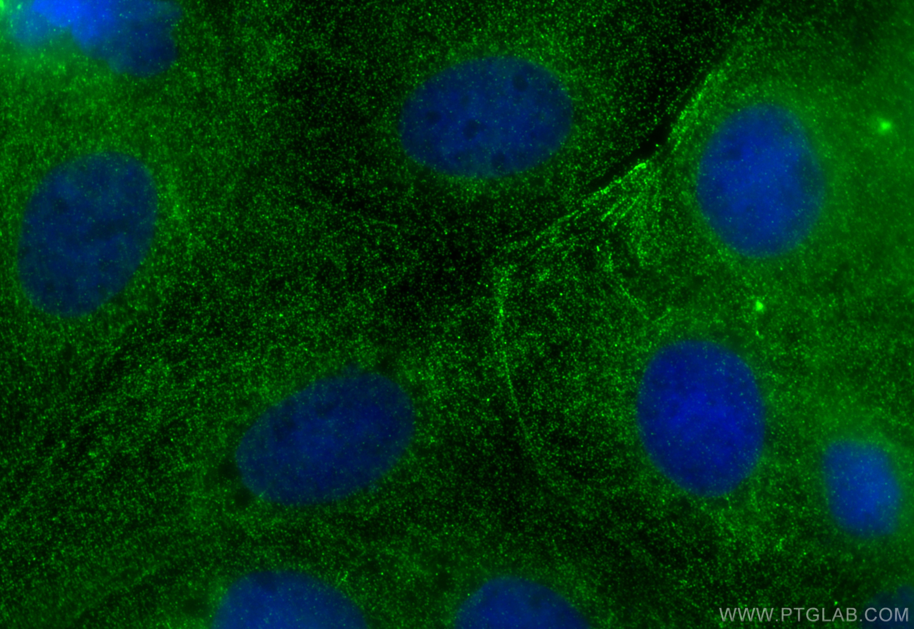 Immunofluorescence (IF) / fluorescent staining of Caco-2 cells using PSMA7 Monoclonal antibody (67817-1-Ig)