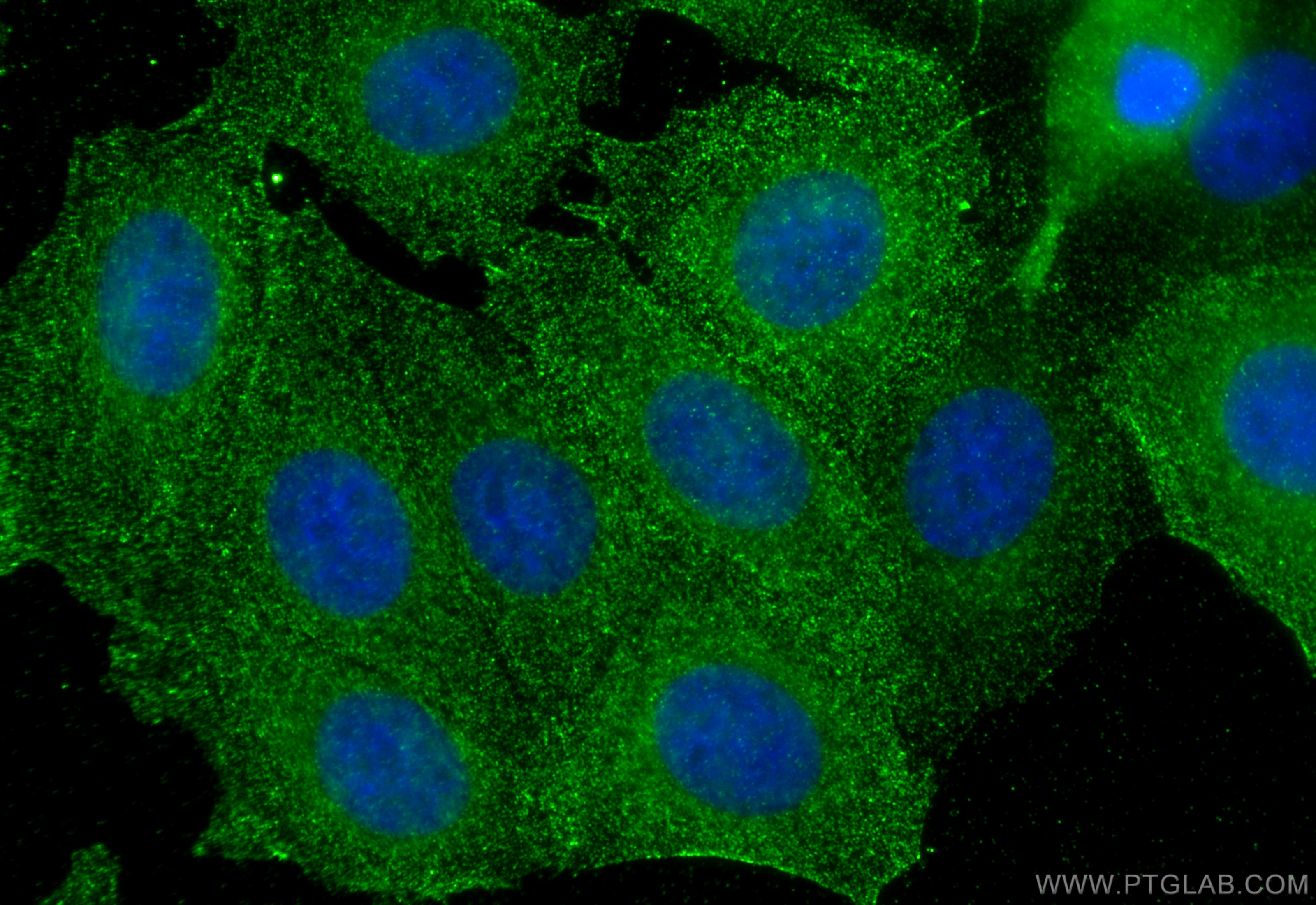 Immunofluorescence (IF) / fluorescent staining of MCF-7 cells using PSMA7 Monoclonal antibody (67817-1-Ig)