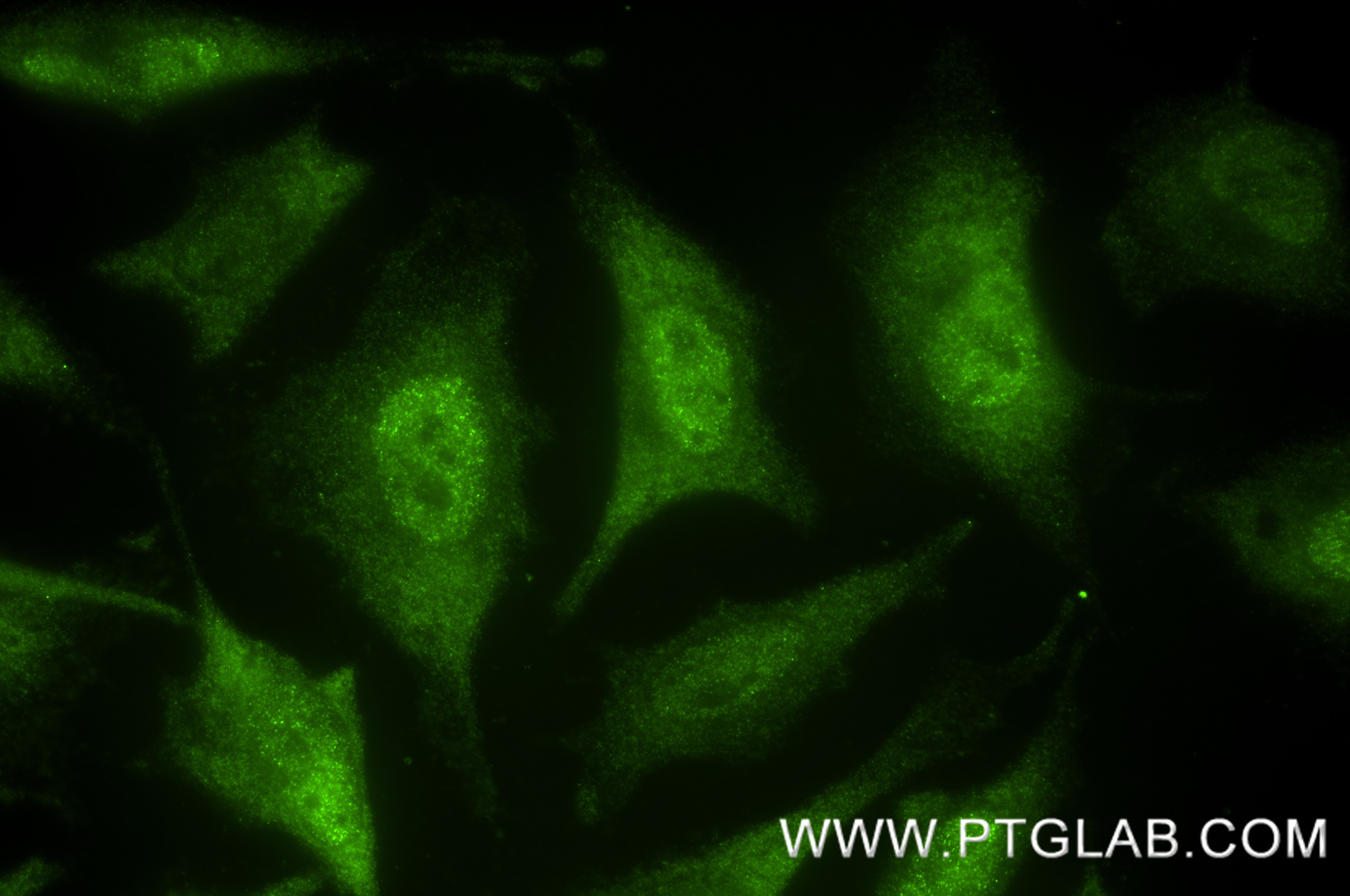 IF Staining of HeLa using 87190-3-RR Immunofluorescence (IF) / fluorescent staining of HeLa cells using PSMA7 Recombinant monoclonal antibody (87190-3-RR)