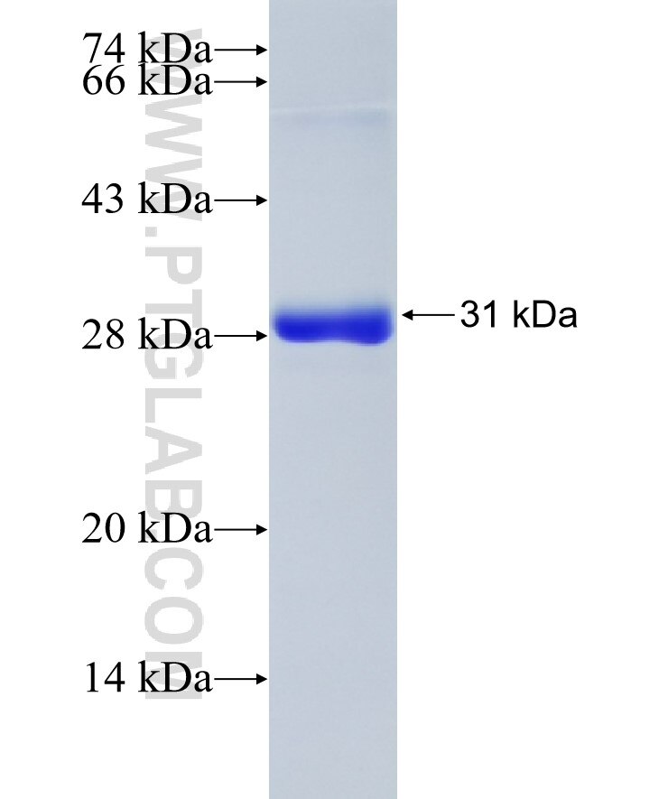 PSMA7 fusion protein Ag7821 SDS-PAGE