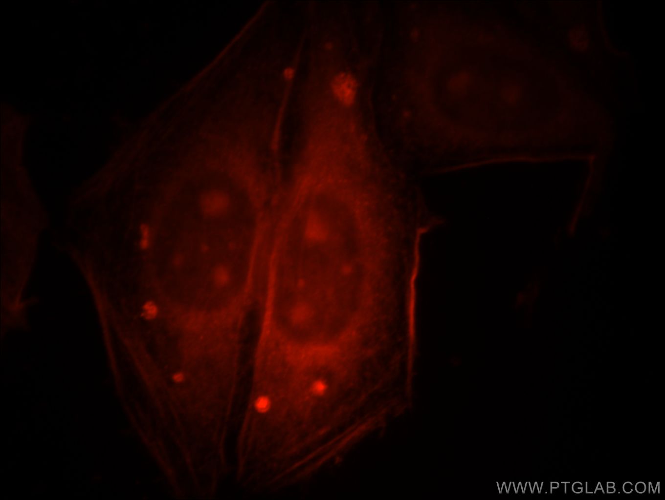 Immunofluorescence (IF) / fluorescent staining of HepG2 cells using PSMA8 Polyclonal antibody (14022-1-AP)