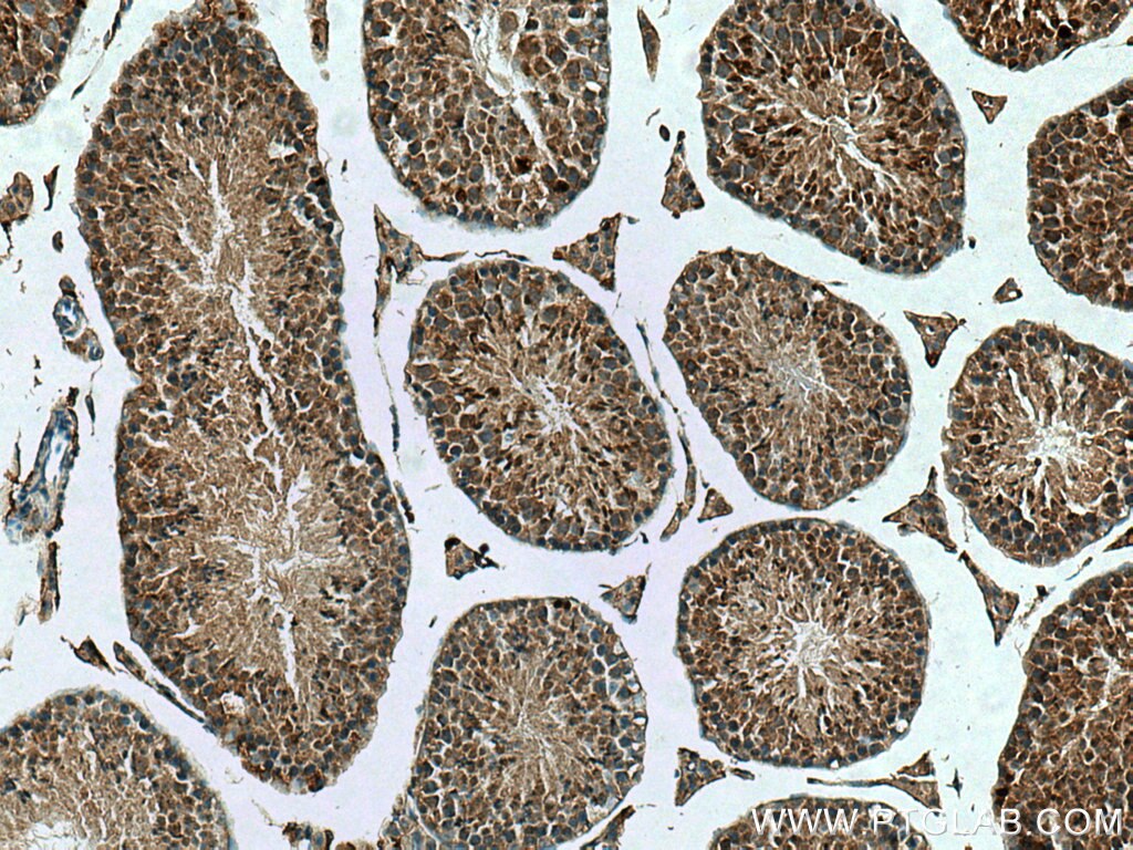 IHC staining of mouse testis using 14022-1-AP