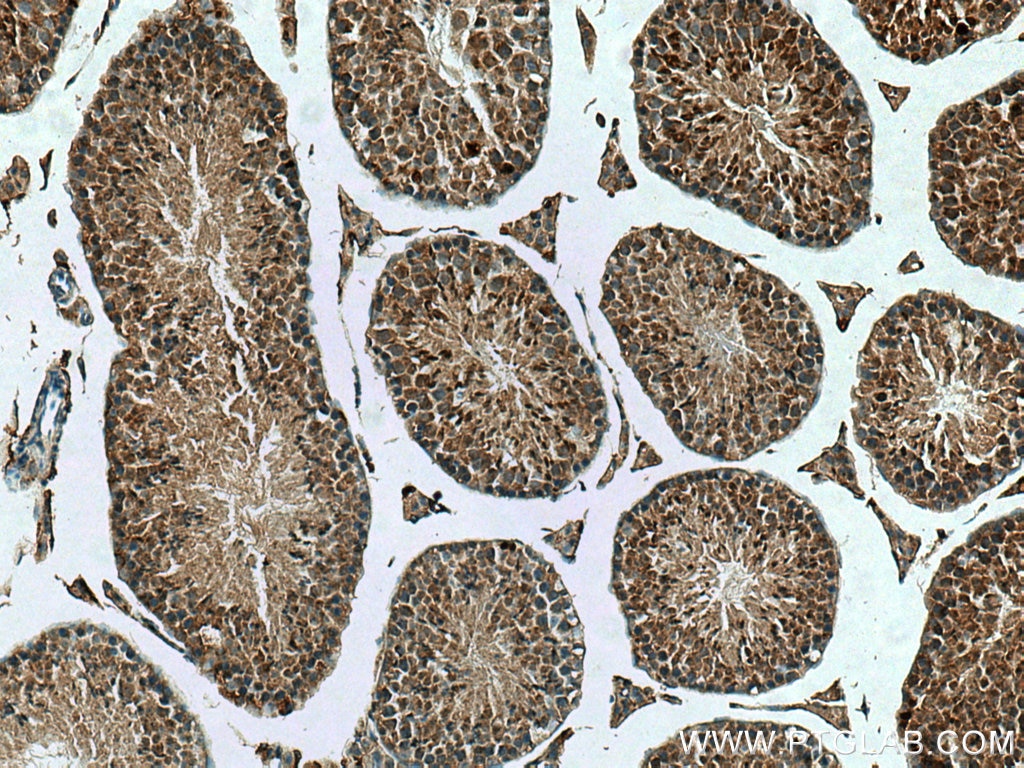 Immunohistochemistry (IHC) staining of mouse testis tissue using PSMA8 Polyclonal antibody (14022-1-AP)