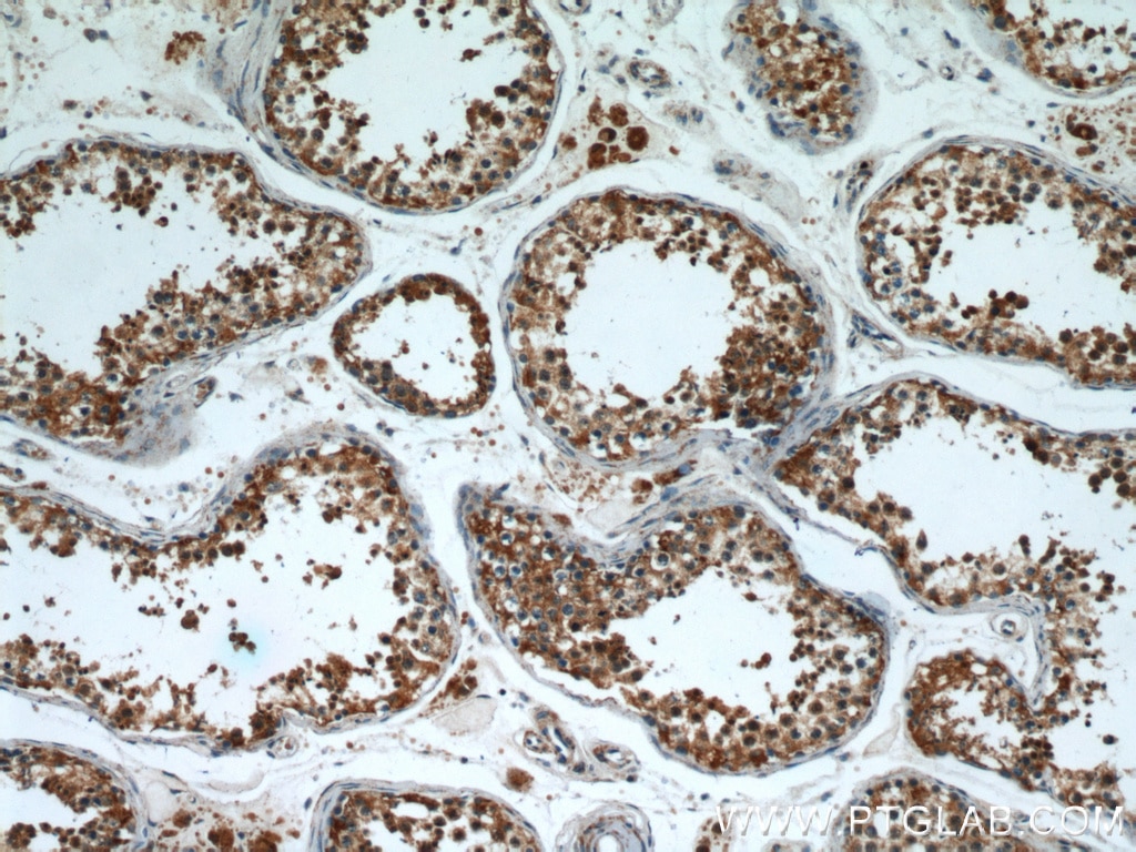 IHC staining of human testis using 14022-1-AP