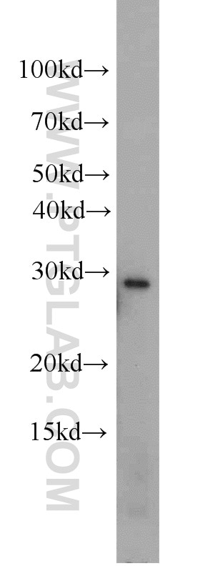 Western Blot (WB) analysis of K-562 cells using PSMA8 Polyclonal antibody (14022-1-AP)