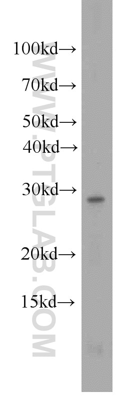 Western Blot (WB) analysis of mouse thymus tissue using PSMA8 Polyclonal antibody (14022-1-AP)