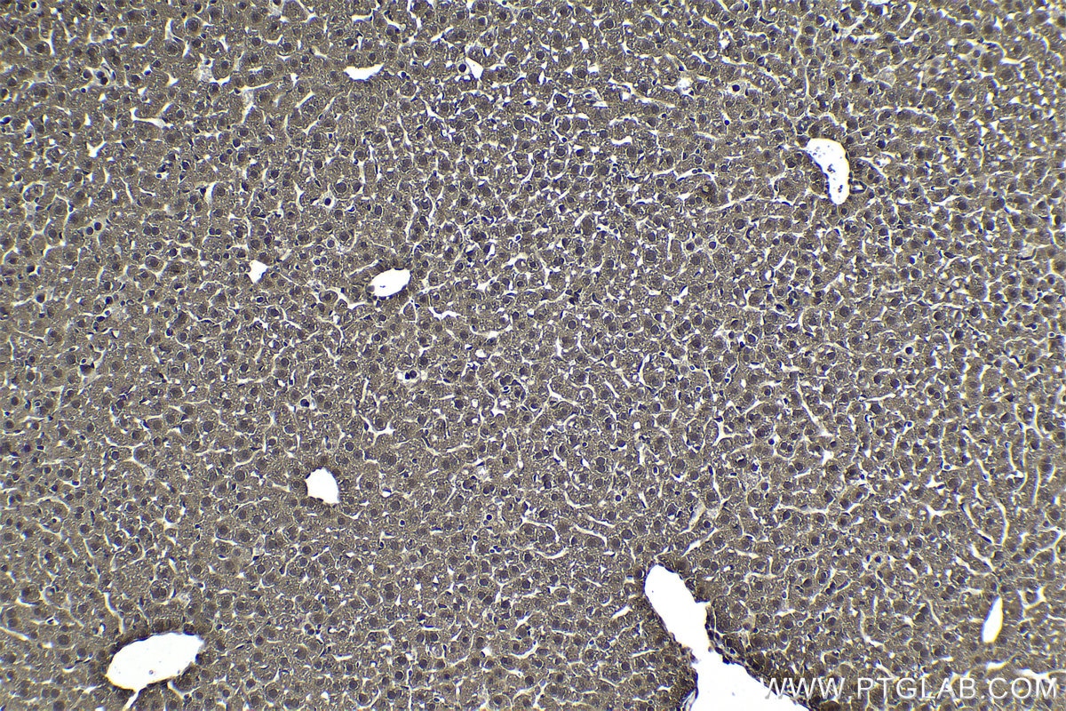 Immunohistochemistry (IHC) staining of mouse liver tissue using PSMA8 Monoclonal antibody (68123-1-Ig)