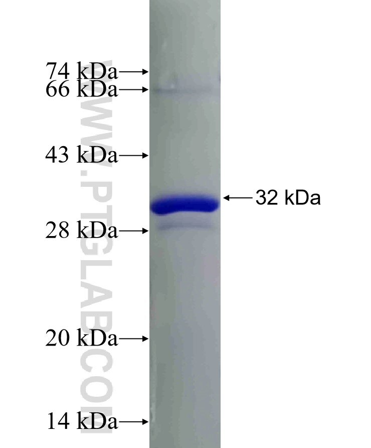 PSMA8 fusion protein Ag5138 SDS-PAGE