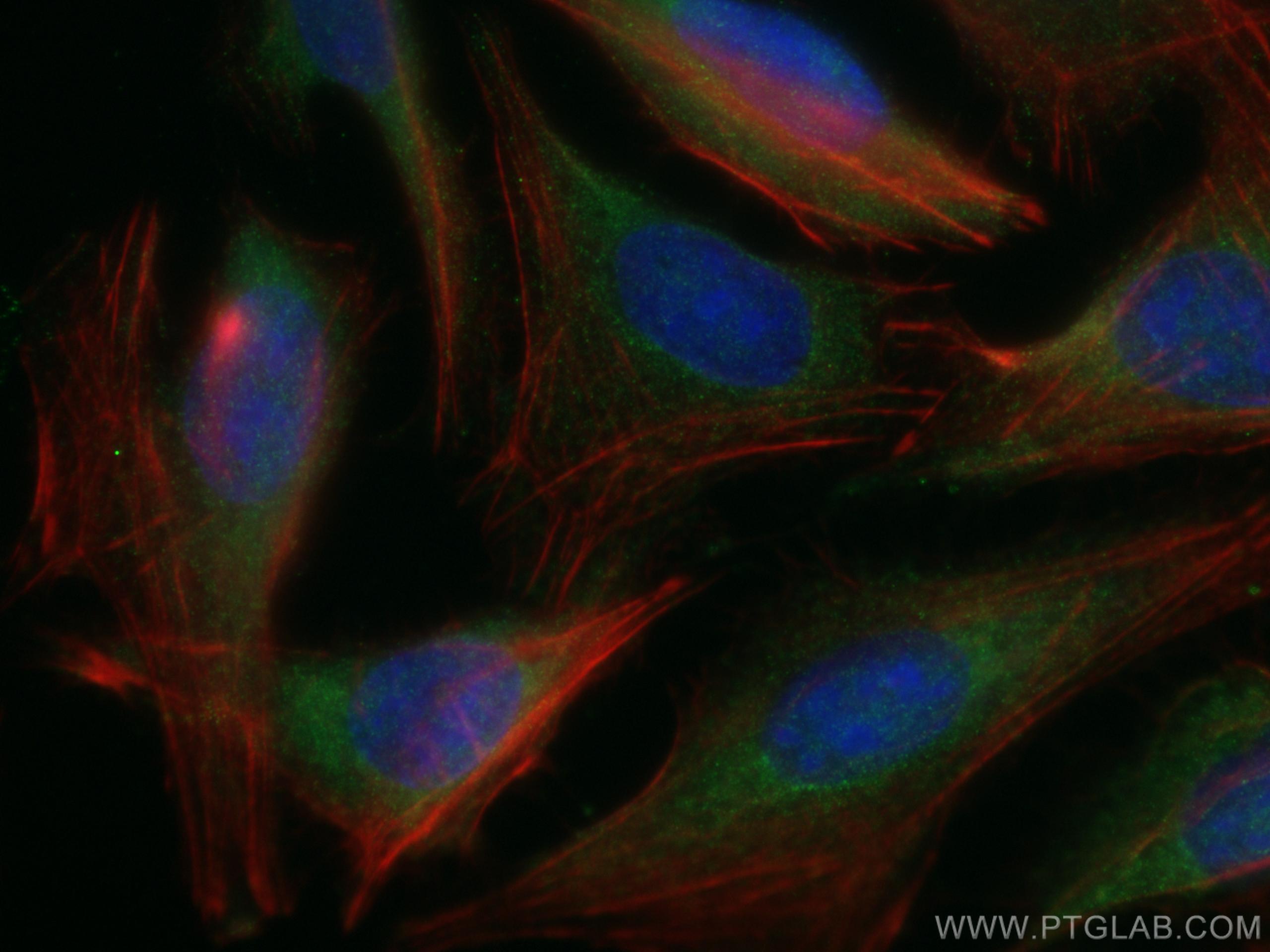 Immunofluorescence (IF) / fluorescent staining of U2OS cells using PSMB1 Polyclonal antibody (11749-1-AP)