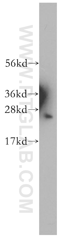 Western Blot (WB) analysis of human brain tissue using PSMB1 Polyclonal antibody (11749-1-AP)