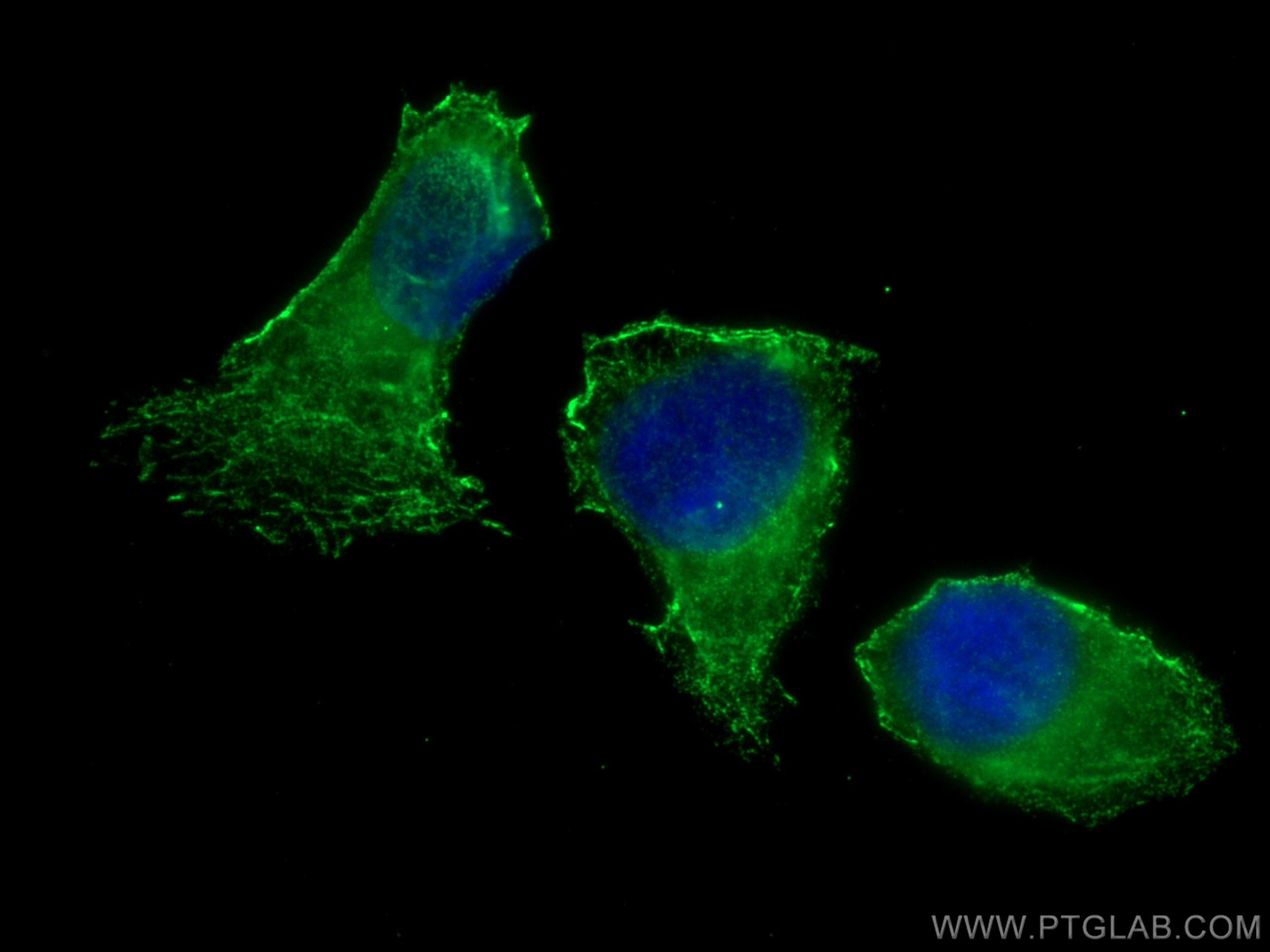 Immunofluorescence (IF) / fluorescent staining of U2OS cells using PSMB1 Monoclonal antibody (67847-1-Ig)