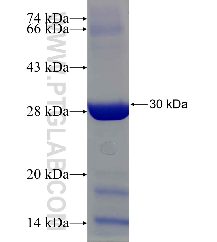 PSMB1 fusion protein Ag30791 SDS-PAGE