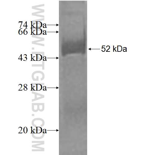 PSMB1 fusion protein Ag2345 SDS-PAGE