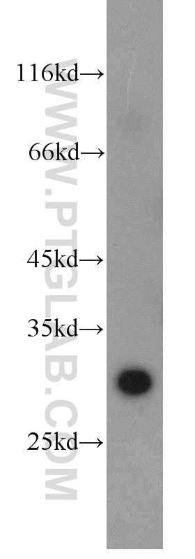 Western Blot (WB) analysis of human liver tissue using PSMB10 Polyclonal antibody (15976-1-AP)