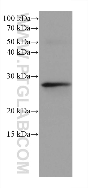 Western Blot (WB) analysis of rat thymus tissue using PSMB10 Monoclonal antibody (66403-1-Ig)