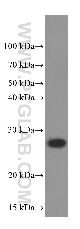 Western Blot (WB) analysis of Raji cells using PSMB10 Monoclonal antibody (66403-1-Ig)