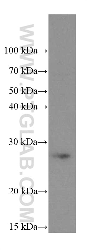 Western Blot (WB) analysis of Ramos cells using PSMB10 Monoclonal antibody (66403-1-Ig)