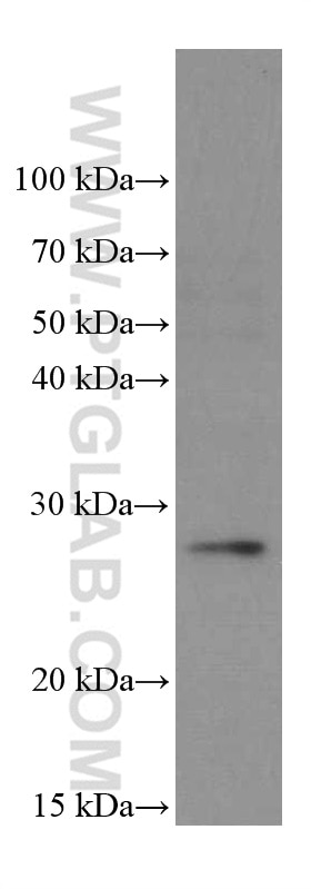 Western Blot (WB) analysis of U-937 cells using PSMB10 Monoclonal antibody (66403-1-Ig)
