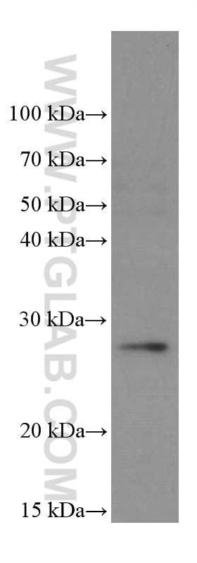 WB analysis of U-937 using 66403-1-Ig