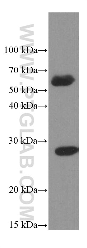 Western Blot (WB) analysis of human spleen tissue using PSMB10 Monoclonal antibody (66403-1-Ig)