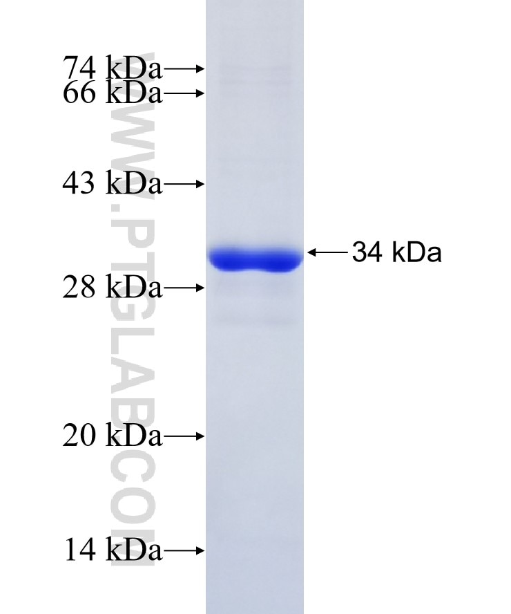 PSMB10 fusion protein Ag8835 SDS-PAGE