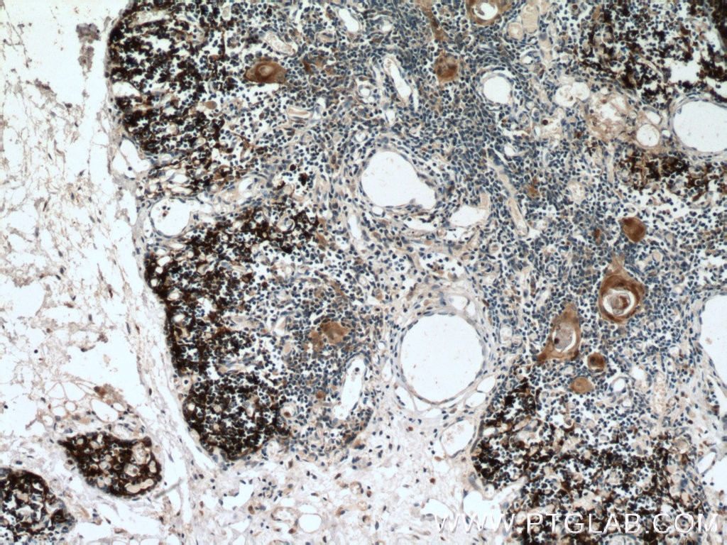 IHC staining of human thymus using 55143-1-AP