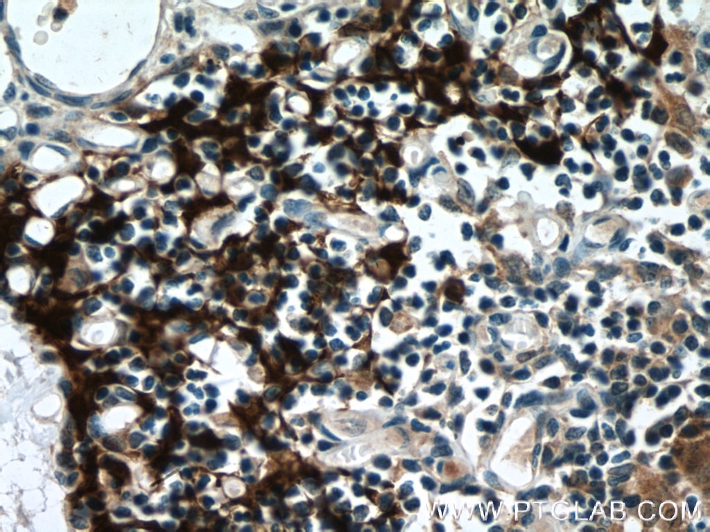 Immunohistochemistry (IHC) staining of human thymus tissue using PSMB11 Polyclonal antibody (55143-1-AP)