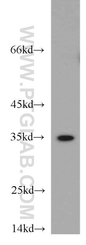 Western Blot (WB) analysis of Jurkat cells using PSMB11 Polyclonal antibody (55143-1-AP)