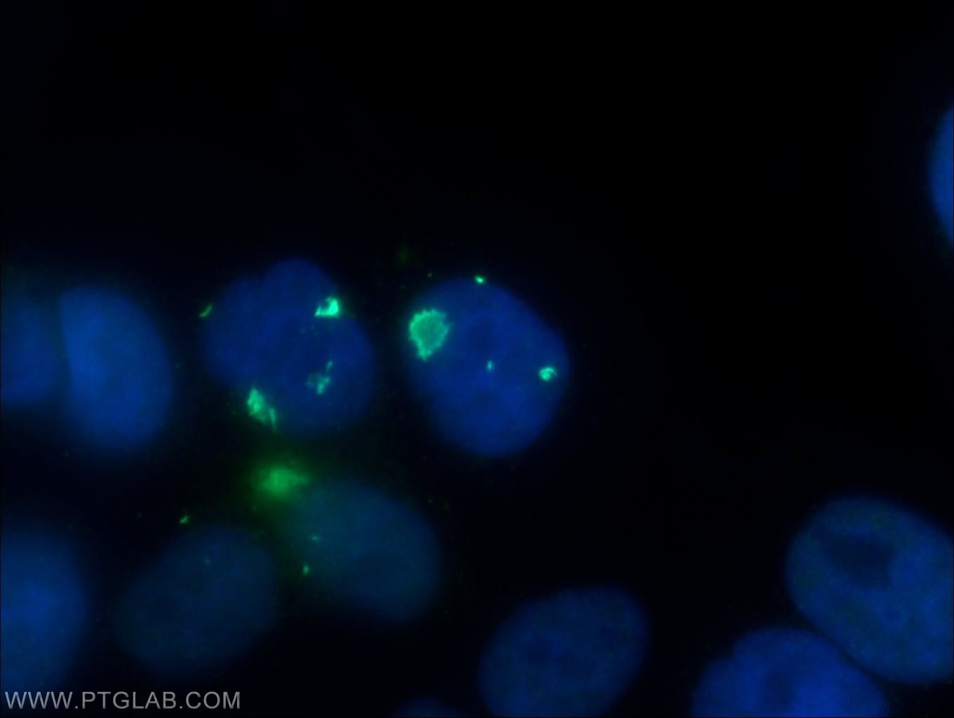 Immunofluorescence (IF) / fluorescent staining of HepG2 cells using PSMB2 Polyclonal antibody (15154-1-AP)