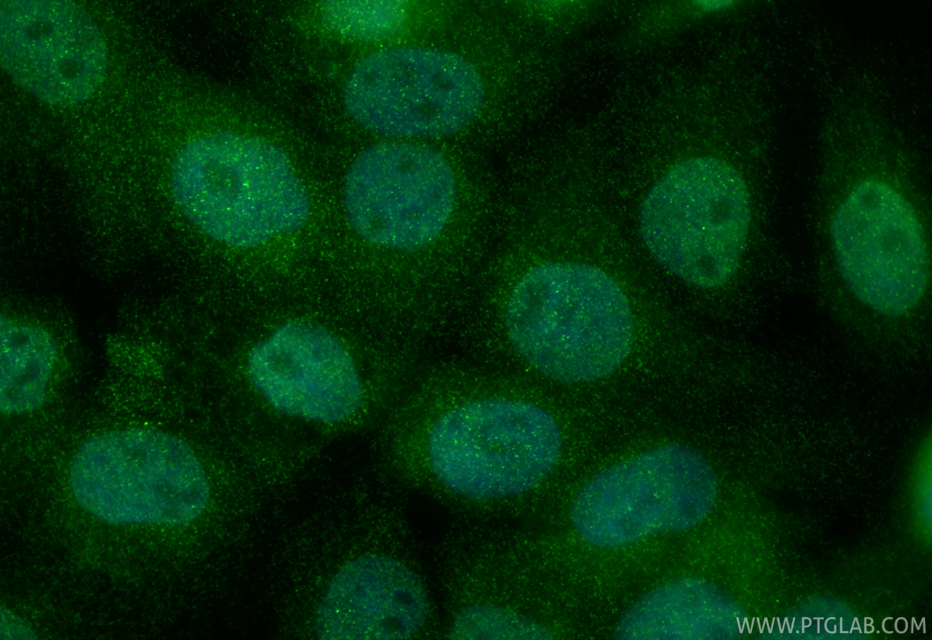 Immunofluorescence (IF) / fluorescent staining of A431 cells using PSMB2 Polyclonal antibody (15154-1-AP)