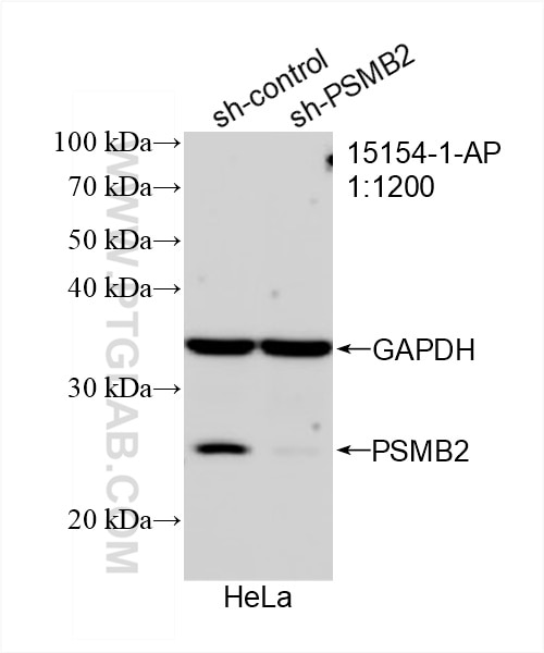 Western Blot (WB) analysis of HeLa cells using PSMB2 Polyclonal antibody (15154-1-AP)