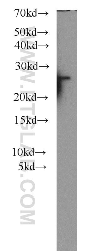 Western Blot (WB) analysis of HEK-293 cells using PSMB2 Polyclonal antibody (15154-1-AP)