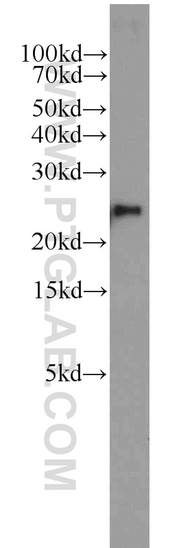 Western Blot (WB) analysis of HeLa cells using PSMB2 Polyclonal antibody (15154-1-AP)