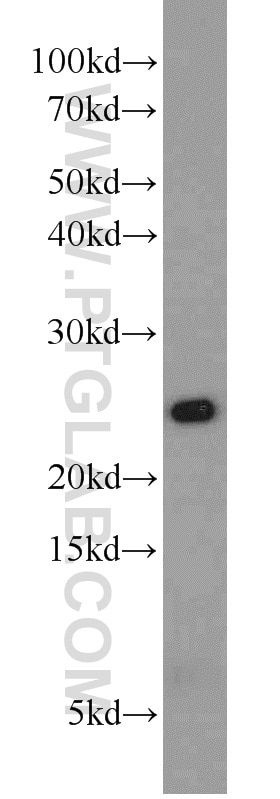 Western Blot (WB) analysis of Jurkat cells using PSMB2 Polyclonal antibody (15154-1-AP)