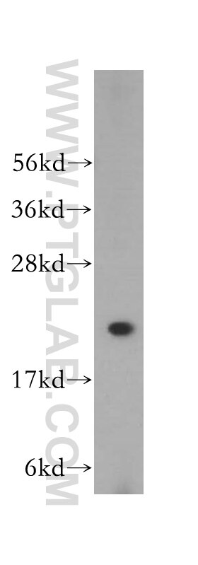 Western Blot (WB) analysis of HeLa cells using PSMB2 Polyclonal antibody (15154-1-AP)