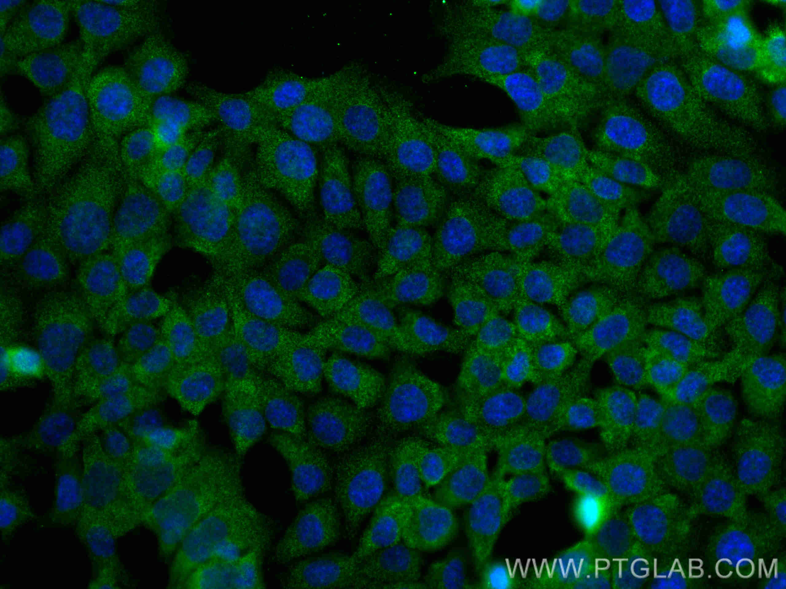 Immunofluorescence (IF) / fluorescent staining of HCT 116 cells using PSMB2 Monoclonal antibody (68180-1-Ig)