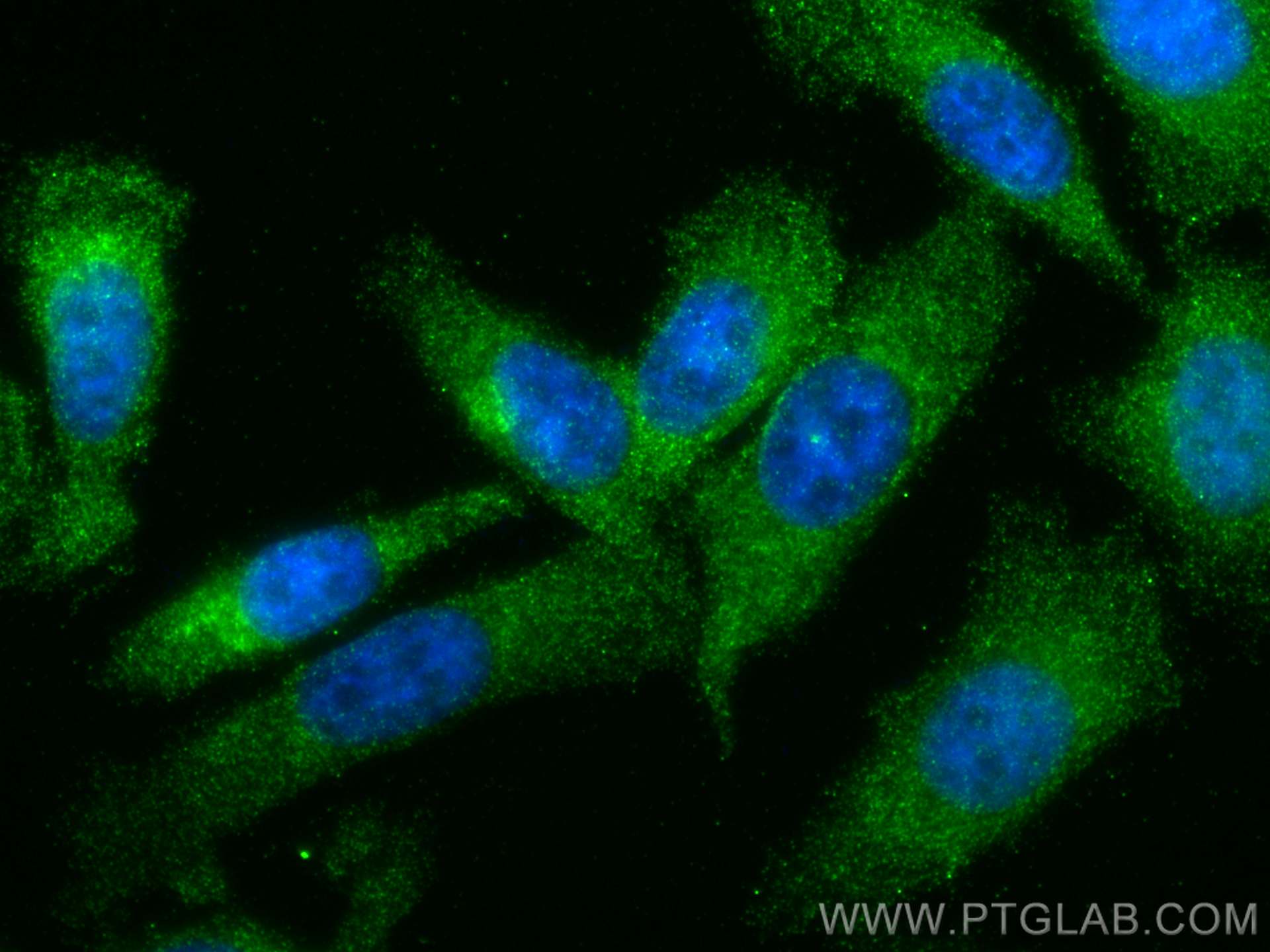 Immunofluorescence (IF) / fluorescent staining of PC-3 cells using PSMB2 Monoclonal antibody (68180-1-Ig)